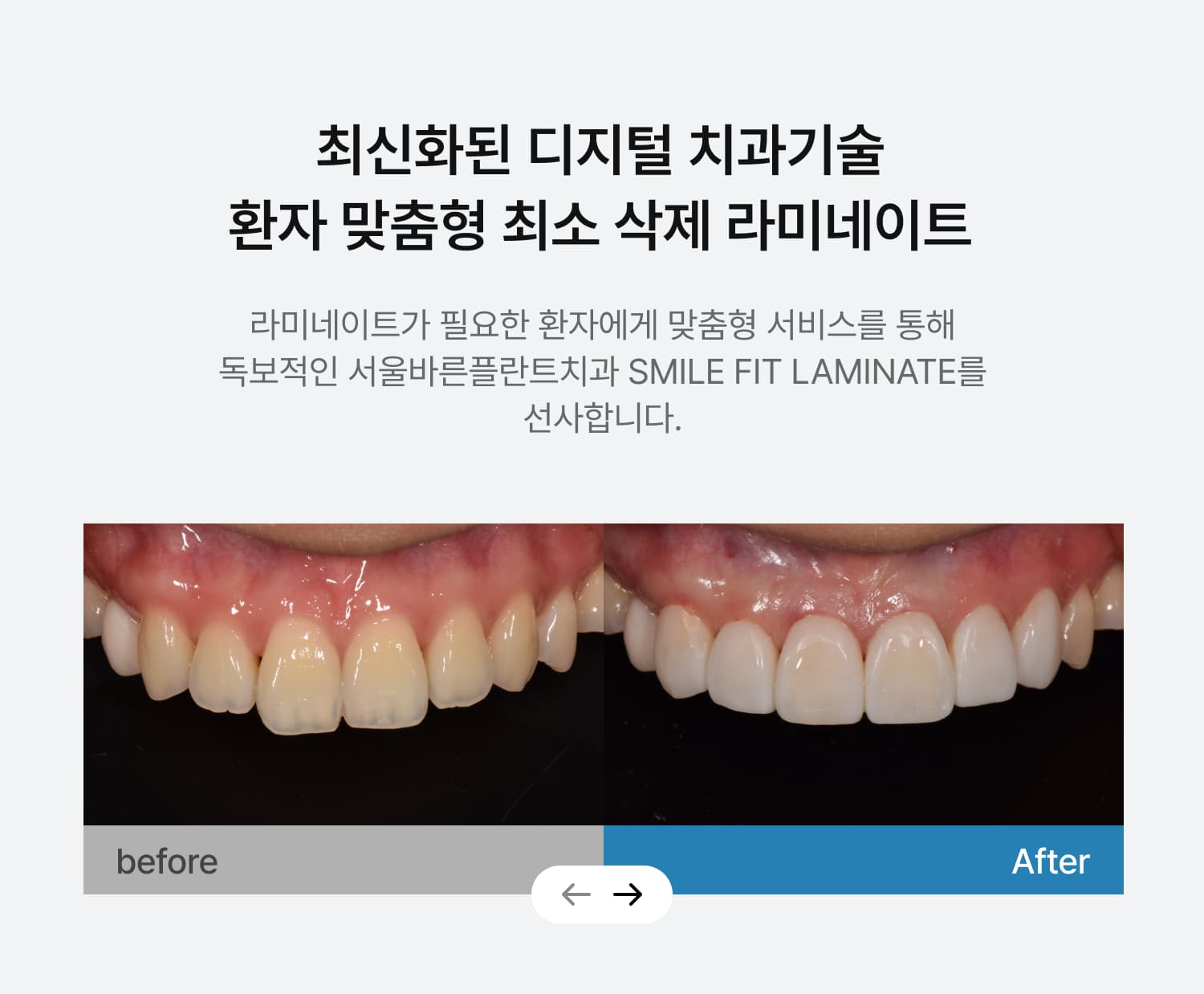 치과 랜딩 페이지 메인 이미지 3